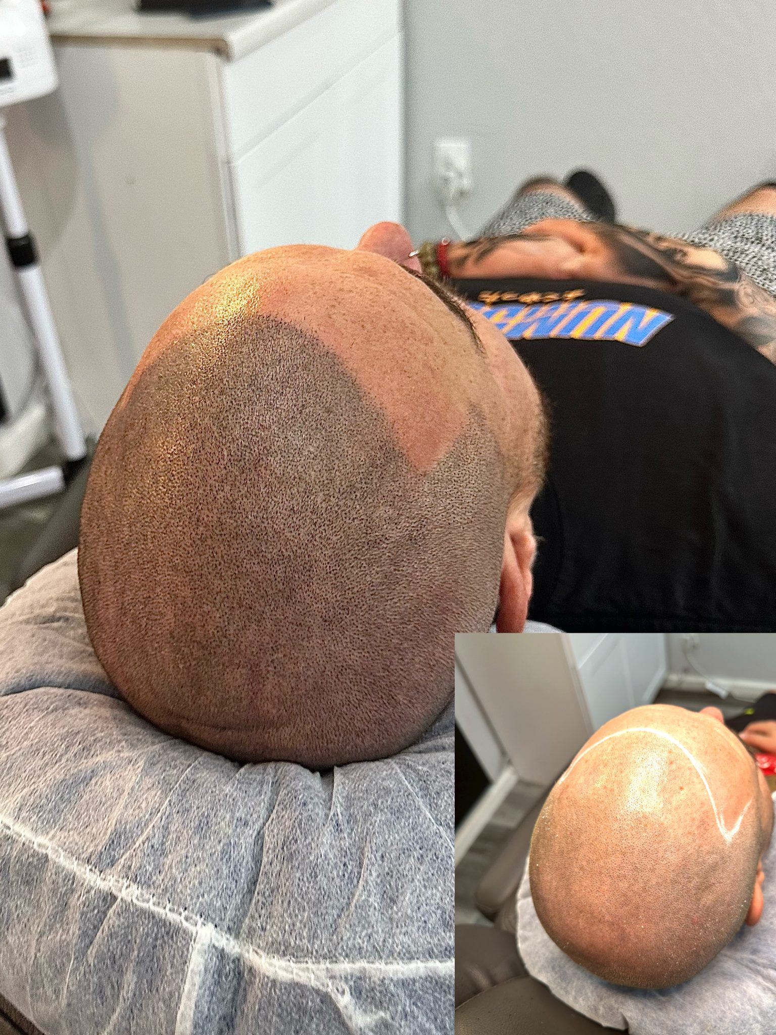 NuHair Ink. Scalp MicroPigmentation & Aesthetics Clinic