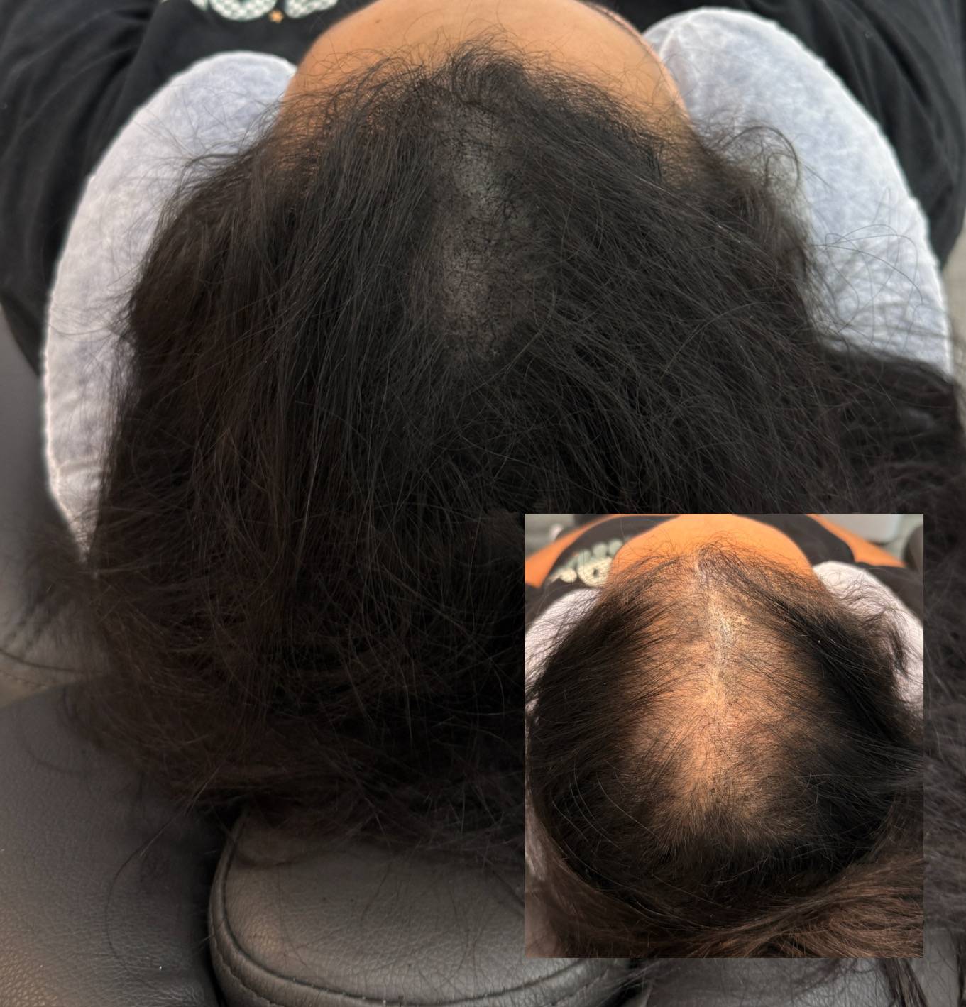 NuHair Ink. Scalp MicroPigmentation & Aesthetics Clinic